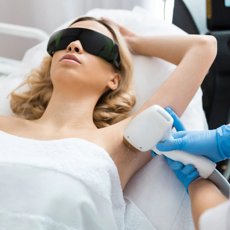 Application of Our Alexandrite Laser Hair Removal Application of Our Alexandrite Laser Hair Removal