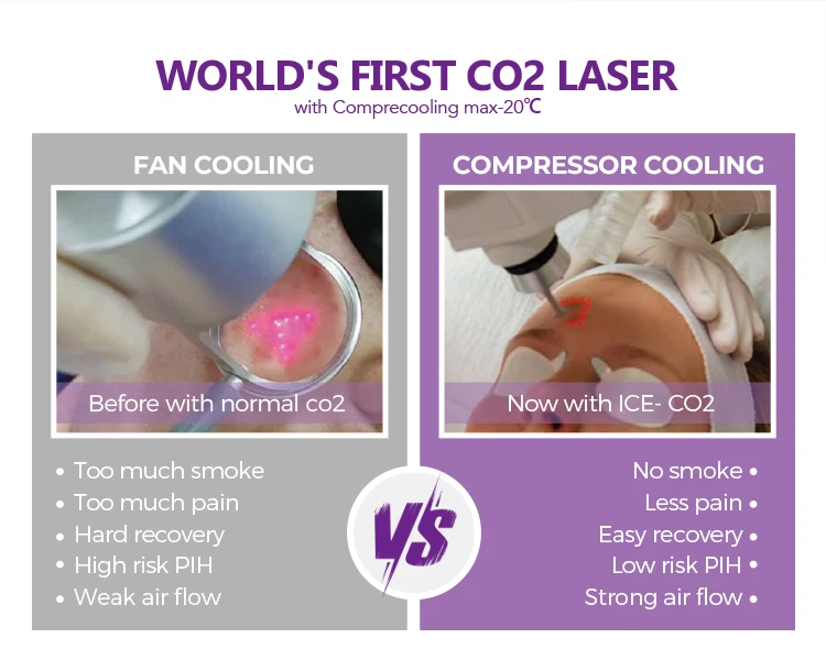 WORLD'S FIRST CO2 LASER WORLD'S FIRST CO2 LASER